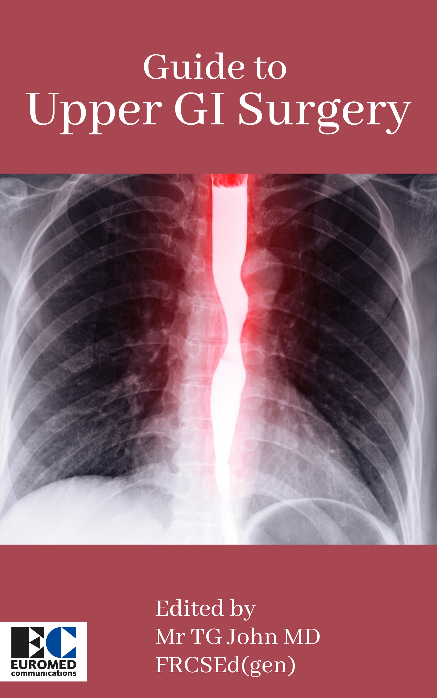 Guide to Upper GI Surgery