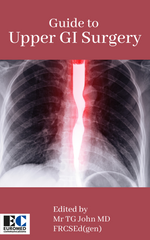 Guide to Upper GI Surgery