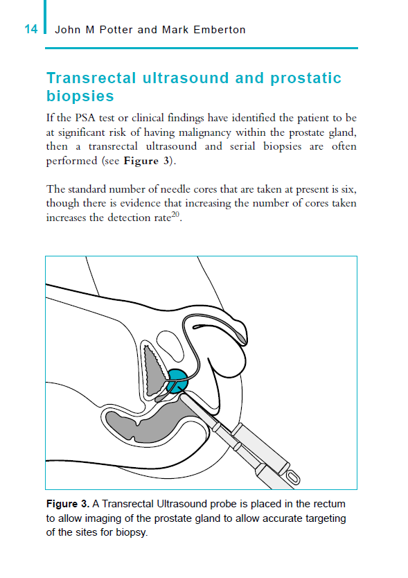PSA and PSA Screening