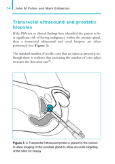 PSA and PSA Screening