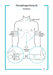 Guide to Upper GI Surgery