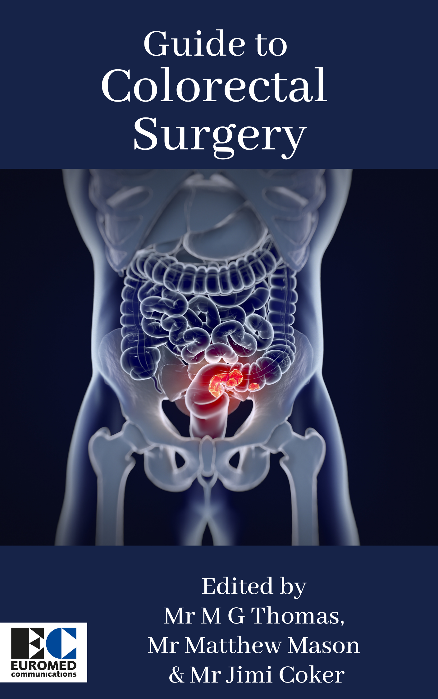 Guide to Colorectal Surgery