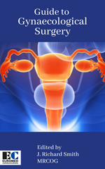 Guide to Gynaecological Surgery