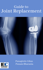 Guide to Joint Replacement